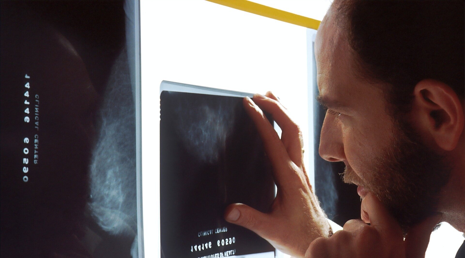X-Ray / Radiology Negligence – When a Radiologist Makes A Mistake
